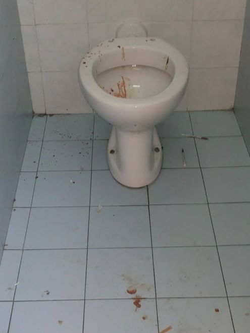 UNIVERSITA� DI BARI: ATENEO, NEL BAGNO SANGUE E SIRINGHE