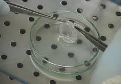 STAMINALI, ITALIANO PRIMO FARMACO IN COMMERCIO: �EFFICACE SU USTIONI CORNEA�